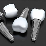 Dental Implants in Farmington, CT