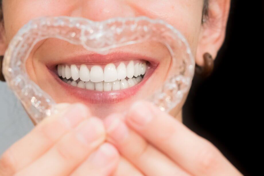 Invisalign vs. Spark: What Farmington Patients Should Know