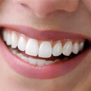 Dental Implants in Farmington, CT