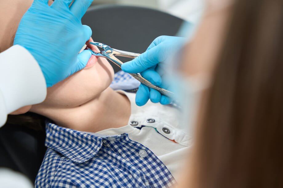 What to Expect After a Tooth Extraction
