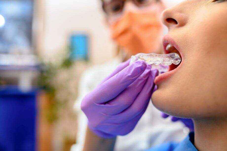 dentist inserting Invisalign into patient's mouth